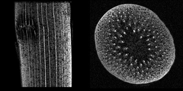 Asparagus MRI image