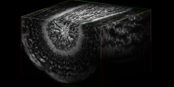 Carrot MRI image