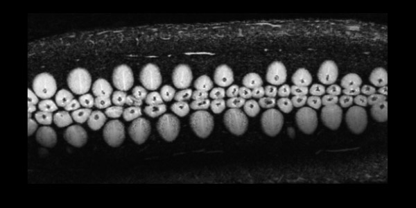 Cucumber MRI image