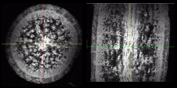 Parsnip MRI image