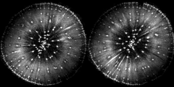 Radish MRI image