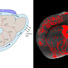 Actual MRI cross-section of the mouse brain, showing injection site