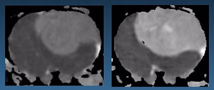 Images of a rat brain produced with the rodent probe used in the 900 MHz NMR magnet.