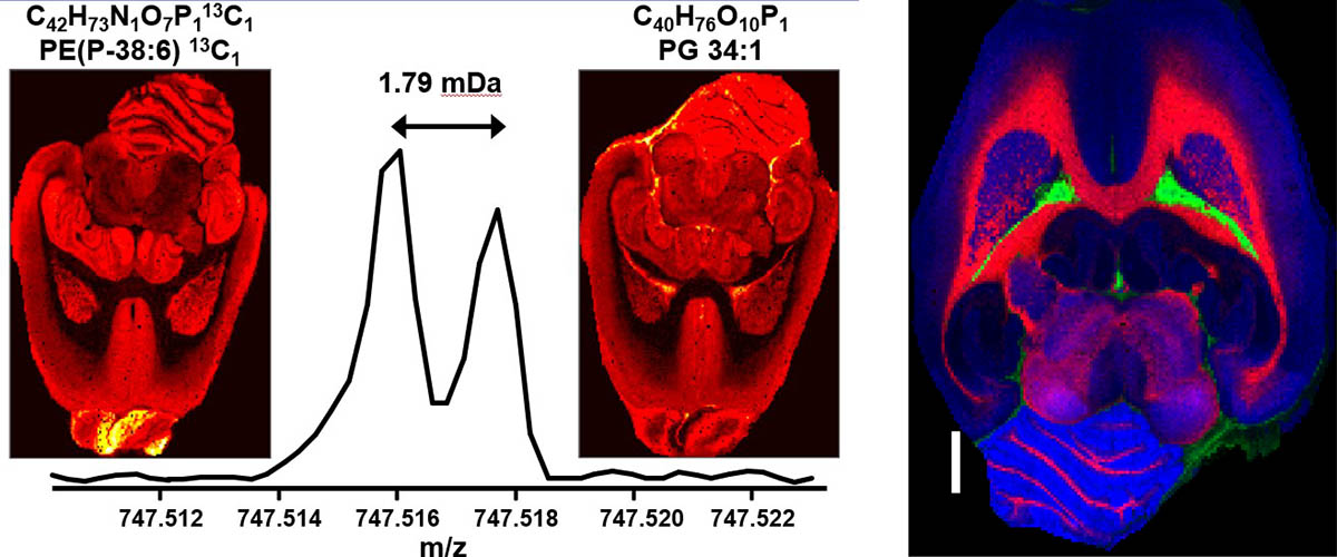 Red: Phosphatidylcholine O-36:2 Green: Sphingomyelin 40:1 Blue: Phosphatidylcholine 40:6