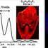 Red: Phosphatidylcholine O-36:2 Green: Sphingomyelin 40:1 Blue: Phosphatidylcholine 40:6