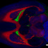 This image of a rat brain, generated with the MagLab's 21-tesla ICR mass spectrometer, reveals the distribution of three specific lipids.