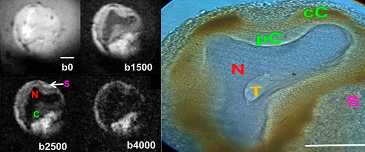 Diffusion MR microscopy of a sea slug neuron at 7.8 μM resolution (left) The cellular structures can also be identified using 40X traditional light microscopy (right).