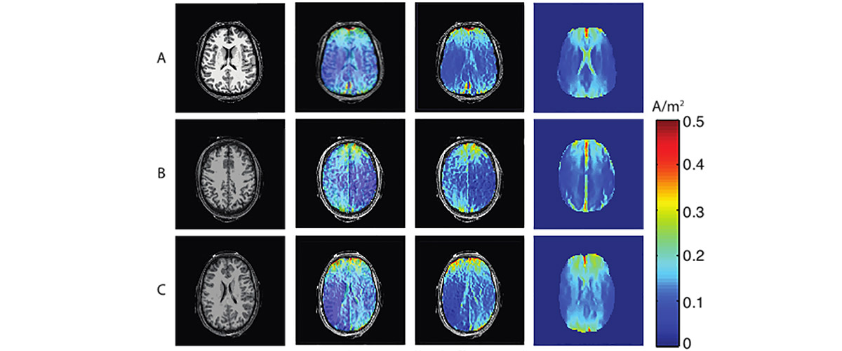 Images show (left to right for two different stimulations) the standard MR image, measured electrical current distribution overlaid on MR image, measured electrical current density alone, and simulated current distribution.