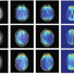 Images show (left to right for two different stimulations) the standard MR image, measured electrical current distribution overlaid on MR image, measured electrical current density alone, and simulated current distribution.