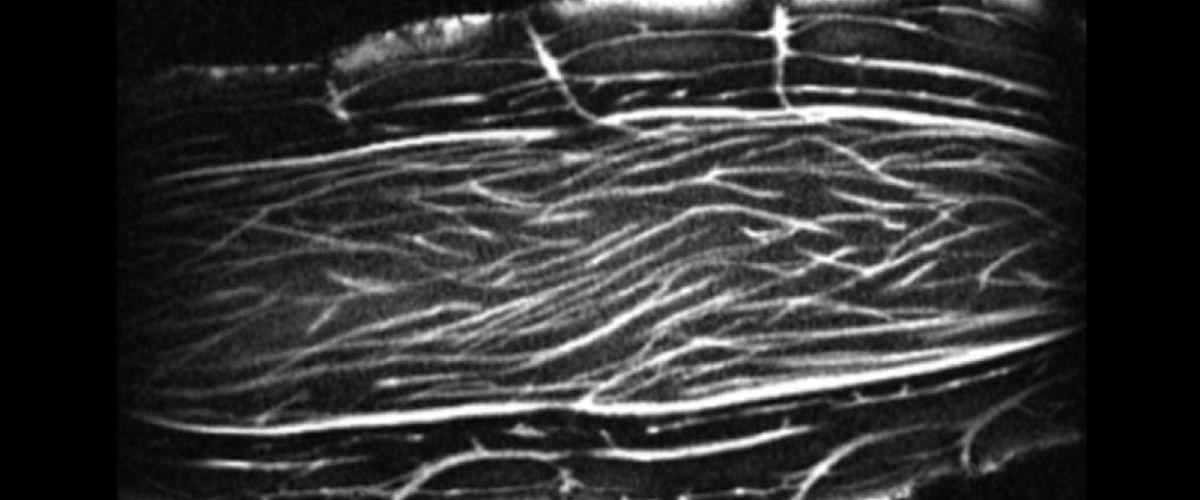 image of turmeric in MRI