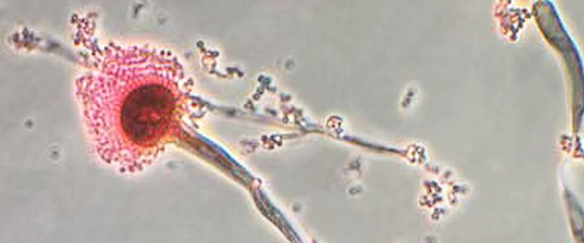 Microscopic image of the fungus Aspergillus fumigatus