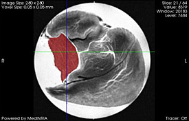 MRI image of the skeletal muscles of a rat's hind leg.