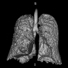 A lung image taken at the MagLab’s AMRIS facility at the University of Florida using hyperpolarized Xenon MRI