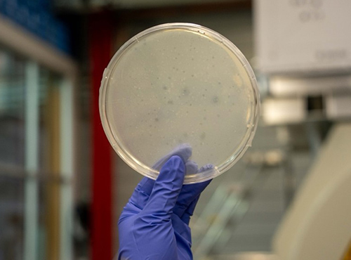 A specimen dish containing predatory bacteria.