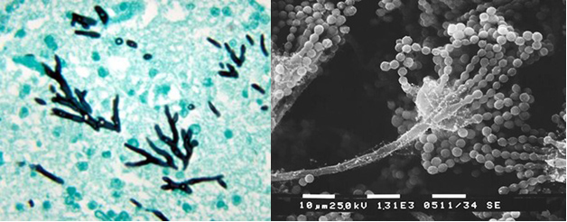 Microscopic images of the fungus Aspergillus fumigatus.