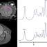 Using MagLab-developed NMR pulse sequences, volumes in the rat cortex (pink boxes) are selected to acquire relaxation-enhanced 1H NMR spectra over 3 hours.